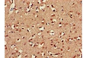 Immunohistochemistry of paraffin-embedded human brain tissue using ABIN7161085 at dilution of 1:100 (CD94 antibody  (AA 42-168))