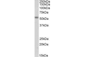 ABIN2560905 (1µg/ml) staining of Mouse Fetal Skeletal Muscle lysate (35µg protein in RIPA buffer). (CHRNE antibody  (Internal Region))