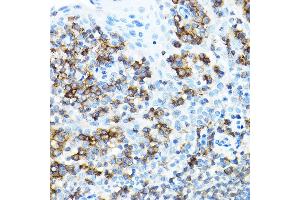 Immunohistochemistry of paraffin-embedded human tonsil using CD27 Rabbit pAb (ABIN3022680, ABIN3022681, ABIN3022682 and ABIN6219092) at dilution of 1:100 (40x lens). (CD27 antibody  (AA 20-191))