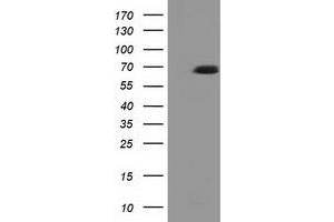 HEK293T cells were transfected with the pCMV6-ENTRY control (Left lane) or pCMV6-ENTRY EPM2AIP1 (Right lane) cDNA for 48 hrs and lysed. (EPM2AIP1 antibody)