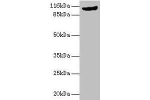 Western blot All lanes: MVP antibody at 2 μg/mL + Rat lung tissue Secondary Goat polyclonal to rabbit IgG at 1/10000 dilution Predicted band size: 100 kDa Observed band size: 110 kDa (MVP antibody  (AA 2-893))
