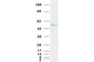 Western Blotting (WB) image for Kininogen 1 (KNG1) (Transcript Variant 2) protein (Myc-DYKDDDDK Tag) (ABIN2724257)