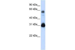 WB Suggested Anti-SOX15 Antibody Titration: 0. (SOX15 antibody  (Middle Region))