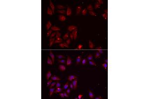 Immunofluorescence analysis of U2OS cells using PDXK antibody (ABIN5974032). (PDXK antibody)