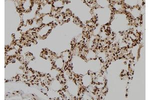 ABIN6275833 at 1/100 staining Rat lung tissue by IHC-P.