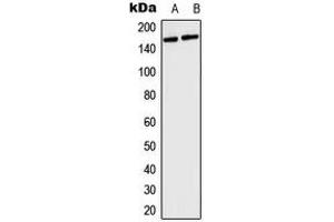 Western blot analysis of Collagen 4 alpha 5 expression in HeLa (A), mouse brain (B) whole cell lysates. (COL4a5 antibody  (N-Term))