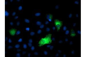 Anti-DPP9 mouse monoclonal antibody (ABIN2455319) immunofluorescent staining of COS7 cells transiently transfected by pCMV6-ENTRY DPP9 (RC224465). (DPP9 antibody)