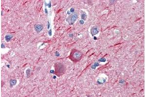 Anti-Alpha Tubulin antibody IHC staining of human brain, cortex. (alpha Tubulin antibody  (Subunit alpha))