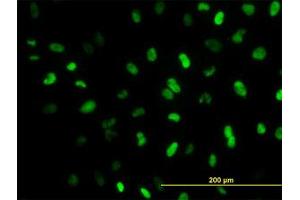 Image no. 5 for anti-Meis Homeobox 2 (MEIS2) (AA 1-382) antibody (ABIN598810) (MEIS2 antibody  (AA 1-382))