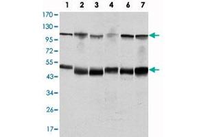 Western blot analysis using NFKB1 monoclonal antibody, clone 5D10D11  against K-562 (1), Jurkat (2), A-431 (3), HeLa (4), THP-1 (5) and MCF-7 (6) cell lysate.