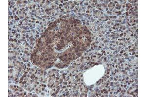 Image no. 1 for anti-Haloacid Dehalogenase-Like Hydrolase Domain Containing 1 (HDHD1) antibody (ABIN1498623) (HDHD1 antibody)