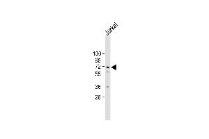 All lanes : Anti-CK2G (CK2 gma) Antibody (C-term) at 1:2000 dilution Lane 1: Jurkat whole cell lysate Lysates/proteins at 20 μg per lane. (CAMKII gamma antibody  (C-Term))