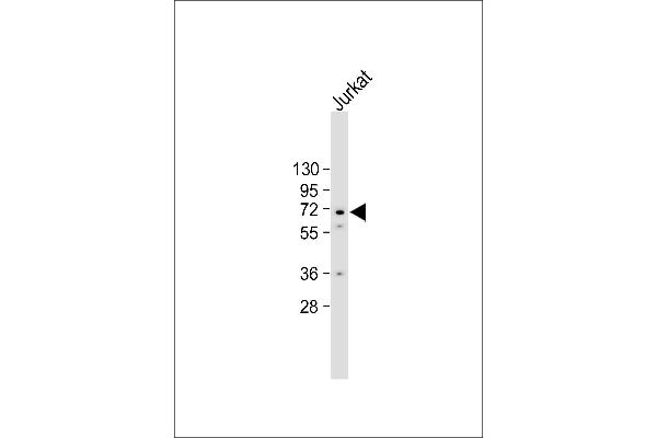 CAMKII gamma antibody  (C-Term)