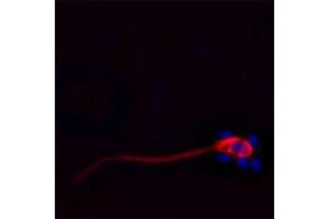 IF on ethanol-fixed human spermatosoid using Mouse monoclonal to Cathelicidin: OSX12 clone  at a concentration of 10 µg/ml. (Cathelicidin antibody)