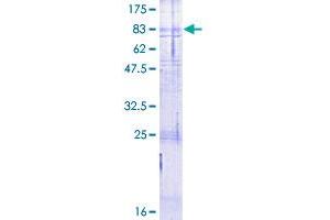 Calcitonin Receptor Protein (CALCR) (AA 1-474) (GST tag)