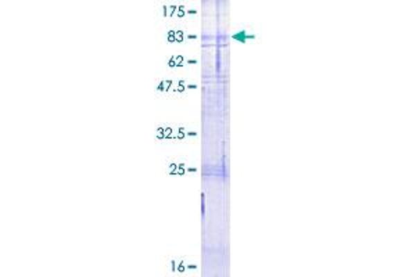 Calcitonin Receptor Protein (CALCR) (AA 1-474) (GST tag)