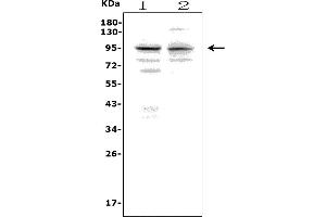 Western blot analysis of Pmel using anti-Pmel antibody (ABIN7601027).