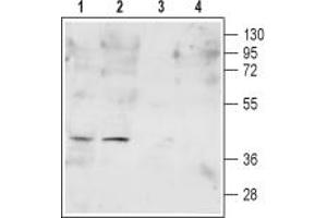 anti-Formyl Peptide Receptor 2 (FPR2) (AA 184-196), (Extracellular) antibody