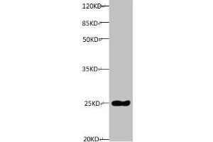 All lanes: Mouse anti-Human Timp1 monoclonal antibody at 1 μg/mL Lane 1: TIMP1 transfected pichia Yeast cell lysate Predicted band size : 23 kDa Observed band size:23 kDa