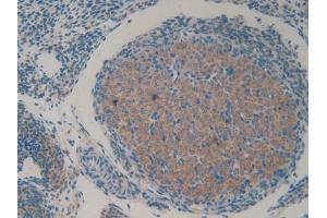 DAB staining on IHC-P; Samples: Mouse Ovary Tissue (HAP1 antibody  (AA 132-328))