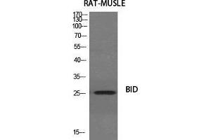 Western Blot (WB) analysis of specific cells using BID Polyclonal Antibody. (BID antibody  (Ser179))