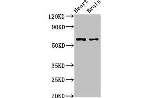 Western Blot Positive WB detected in: Mouse heart tissue, Mouse brain tissue All lanes: CYP3A4 antibody at 2. (CYP3A4 antibody  (AA 259-441))