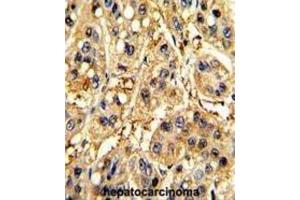 Immunohistochemistry (IHC) image for anti-Secreted Frizzled-Related Protein 5 (SFRP5) antibody (ABIN3002916) (SFRP5 antibody)