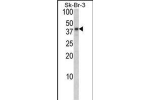 Western blot analysis of BGN Antibody (Center) (ABIN390701 and ABIN2840987) in Sk-Br-3 cell line lysates (35 μg/lane). (Biglycan antibody  (AA 148-176))
