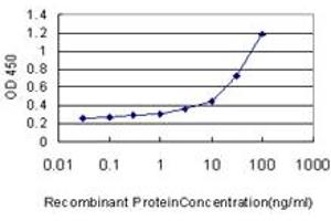 Detection limit for recombinant GST tagged UROD is approximately 1ng/ml as a capture antibody. (UROD antibody  (AA 268-367))