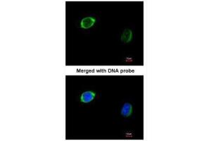 ICC/IF Image Immunofluorescence analysis of paraformaldehyde-fixed HeLa, using RAB2B, antibody at 1:200 dilution. (RAB2B antibody)