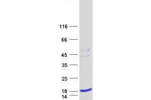 Validation with Western Blot (SPCS1 Protein (Myc-DYKDDDDK Tag))