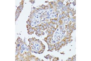 Immunohistochemistry (IHC) image for anti-Histidine Ammonia-Lyase (HAL) (AA 1-200) antibody (ABIN6141593)