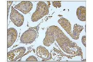 IHC analysis of BubR1/BUB1B using anti-BubR1/BUB1B antibody (ABIN7600962).