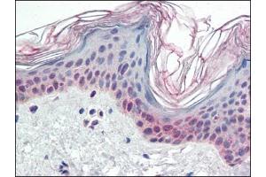 Human Skin (formalin-fixed, paraffin-embedded) stained with PARP2at 2. (PARP2 antibody  (Internal Region))