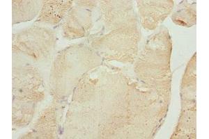 Immunohistochemistry of paraffin-embedded human skeletal muscle tissue using ABIN7173581 at dilution of 1:100 (TNNI2 antibody  (AA 1-100))