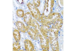 Immunohistochemistry of paraffin-embedded mouse kidney using  antibody (ABIN7265428) at dilution of 1:100 (40x lens). (ACOT2 antibody  (AA 222-483))