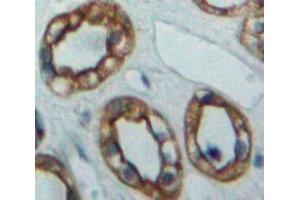 Used in DAB staining on fromalin fixed paraffin-embedded Kidney tissue