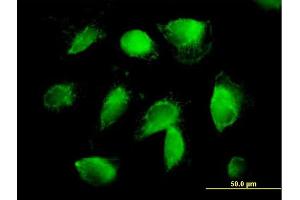 Immunofluorescence of purified MaxPab antibody to F2 on HepG2 cell. (Prothrombin antibody  (AA 1-622))