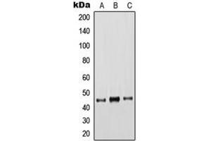 Western blot analysis of Cytokeratin 18 expression in HeLa (A), A431 (B), MCF7 (C) whole cell lysates. (Cytokeratin 18 antibody  (C-Term))