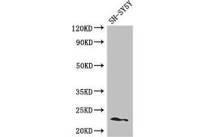 Western Blot Positive WB detected in: SH-SY5Y whole cell lysate All lanes: PEMT antibody at 2. (PEMT antibody  (AA 2-49))