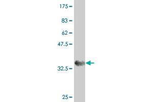 Western Blot detection against Immunogen (35. (PRP19 antibody  (AA 1-90))