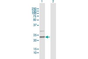 Western Blot analysis of C7orf30 expression in transfected 293T cell line by C7orf30 MaxPab polyclonal antibody. (C7orf30 antibody  (AA 1-234))