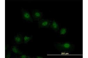 Immunofluorescence of monoclonal antibody to VRK2 on HeLa cell. (VRK2 antibody  (AA 260-360))