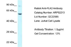 Western Blotting (WB) image for anti-Polo-Like Kinase 2 (PLK2) (Middle Region) antibody (ABIN2784827) (PLK2 antibody  (Middle Region))