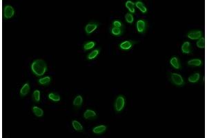 Immunofluorescence staining of Hela cells (treated with 30mM sodium butyrate for 4h) with ABIN7139152 at 1:5, counter-stained with DAPI. (Histone H2B antibody  (acLys12))