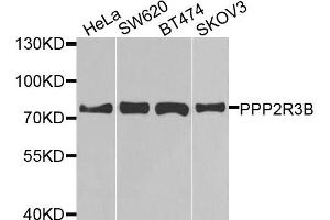 Western blot analysis of extracts of various cell lines, using PPP2R3B antibody (ABIN5974610) at 1/1000 dilution. (PPP2R3B antibody)