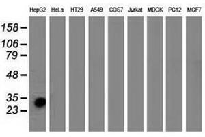 Image no. 2 for anti-Sulfotransferase Family, Cytosolic, 1A, Phenol-Preferring, Member 1 (SULT1A1) antibody (ABIN1501225)