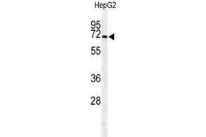Western blot analysis of ARSI Antibody (C-term) in HepG2 cell line lysates (35µg/lane). (Arylsulfatase I antibody  (C-Term))
