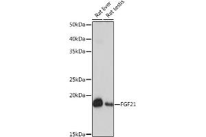 Western blot analysis of extracts of various cell lines, using FGF21 Rabbit mAb (ABIN1680154, ABIN3018263, ABIN3018264 and ABIN7101589) at 1:1000 dilution. (FGF21 antibody)