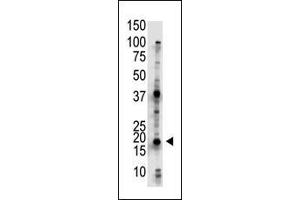 The anti-UBE2G2 Pab (ABIN388861 and ABIN2839163) is used in Western blot to detect UBE2G2 in Jurkat cell lysate. (UBE2G2 antibody  (N-Term))